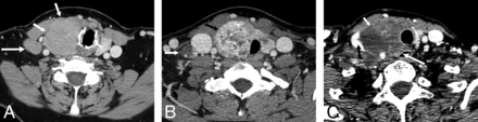 Fig 5.