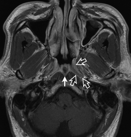 Fig 7.
