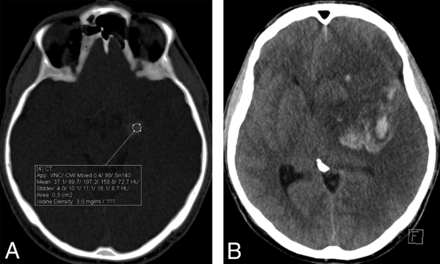 Fig 1.