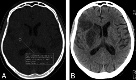Fig 2.