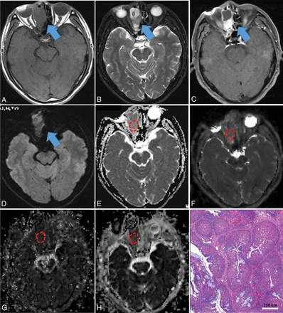 Fig 3.