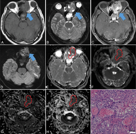 Fig 4.