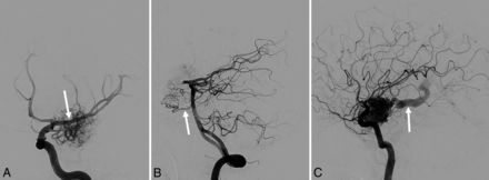 Fig 1.