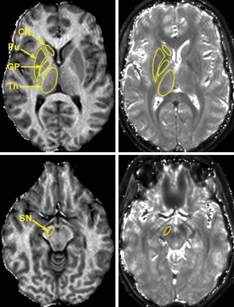 Fig 1.