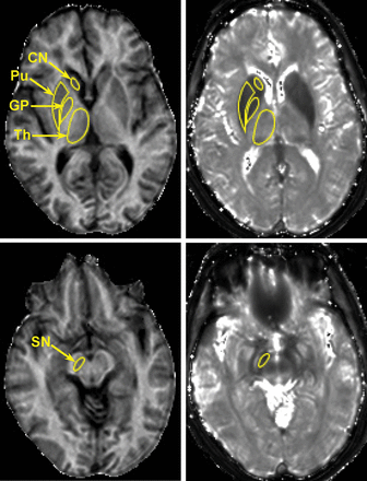 Fig 2.