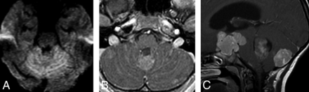 Fig 3.