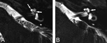 Fig 1.
