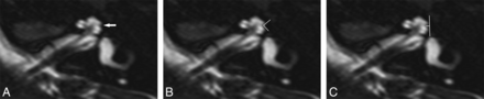Fig 2.