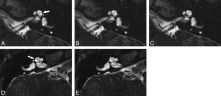 Fig 3.