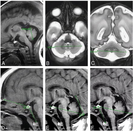 Fig 1.
