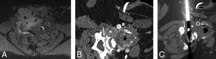 Fig 2.