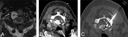 Fig 3.