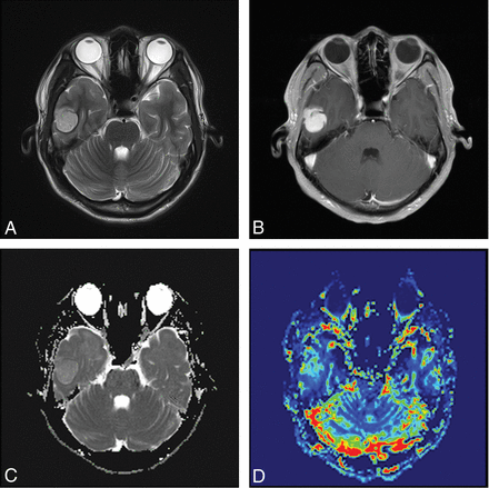 Fig 1.
