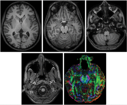 Fig 1.