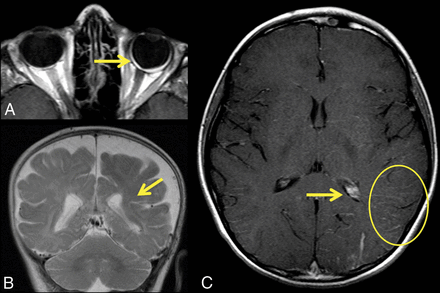 Fig 1.