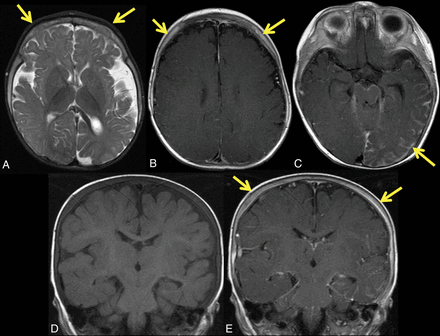 Fig 3.