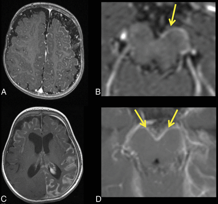 Fig 5.
