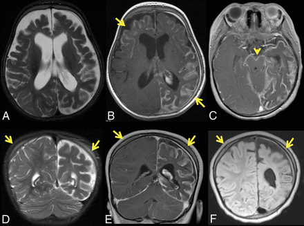 Fig 6.
