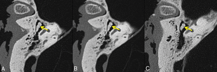 Fig 4.