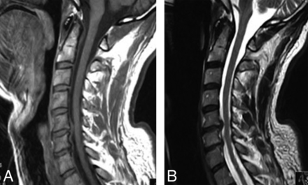 Fig 2.