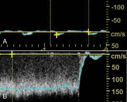 Fig 4.