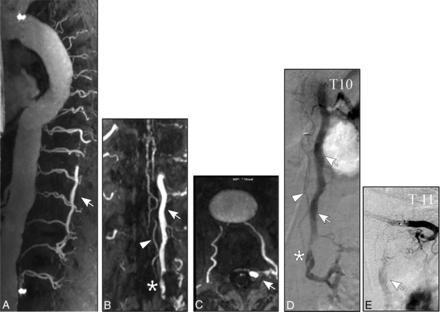 Fig 3.