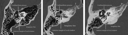 Fig 1.