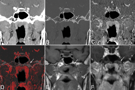 Fig 2.