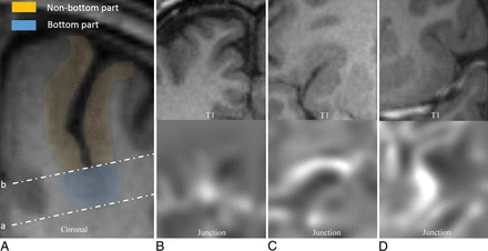 Fig 2.