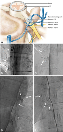 Fig 4.