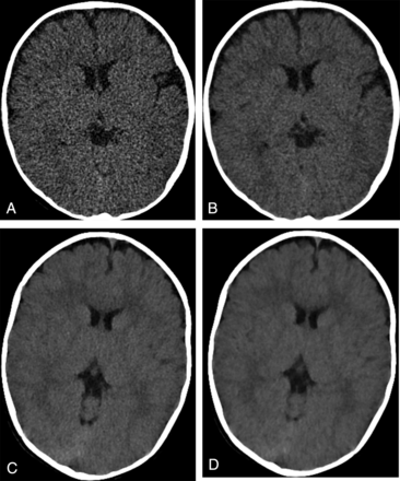 Fig 2.