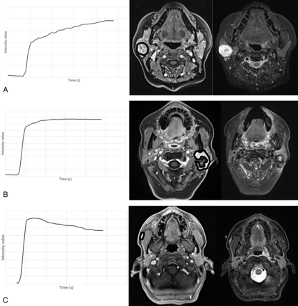 Fig 2.