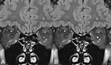 Fig 1.