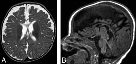 Fig 3.