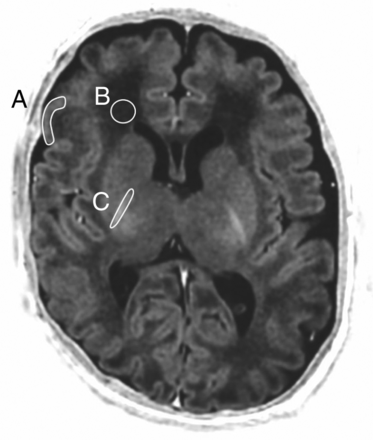 Fig 1.