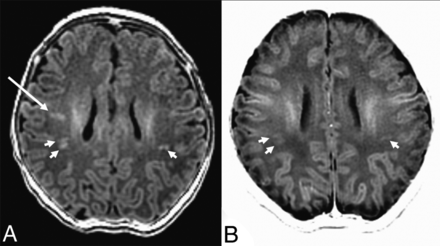 Fig 3.