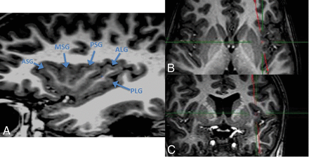 Fig 1.