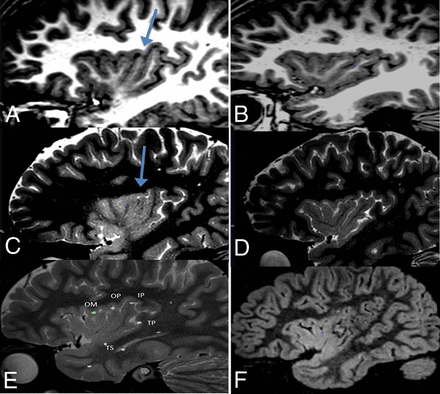 Fig 3.