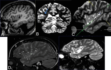 Fig 4.