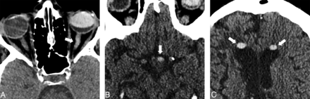 Fig 3.