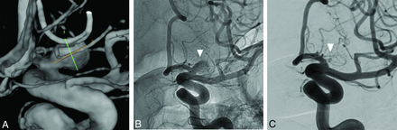 Fig 1.