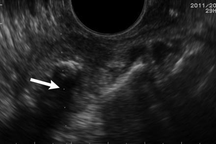 Fig 1.