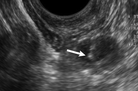 Fig 2.