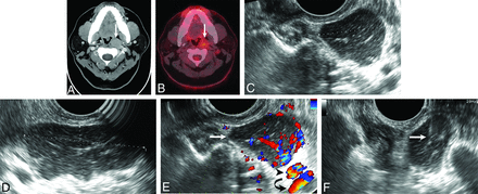 Fig 4.