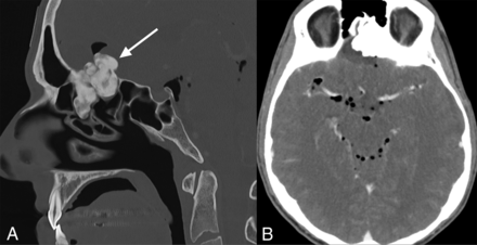 Fig 10.