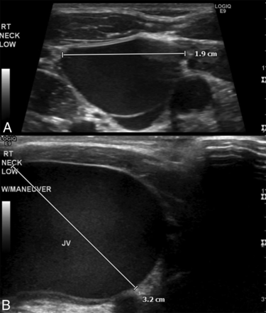 Fig 3.