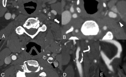 FIG 2.