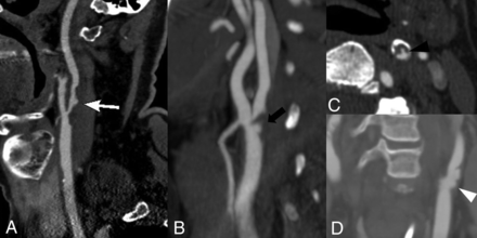 FIG 3.