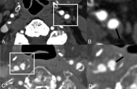 FIG 4.