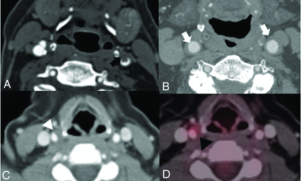 FIG 5.